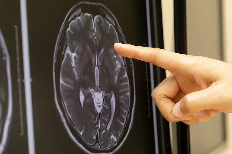 オンライン診療のメリット